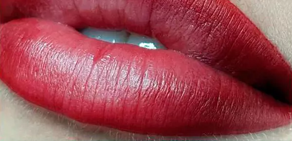 Lip micropigmentation.